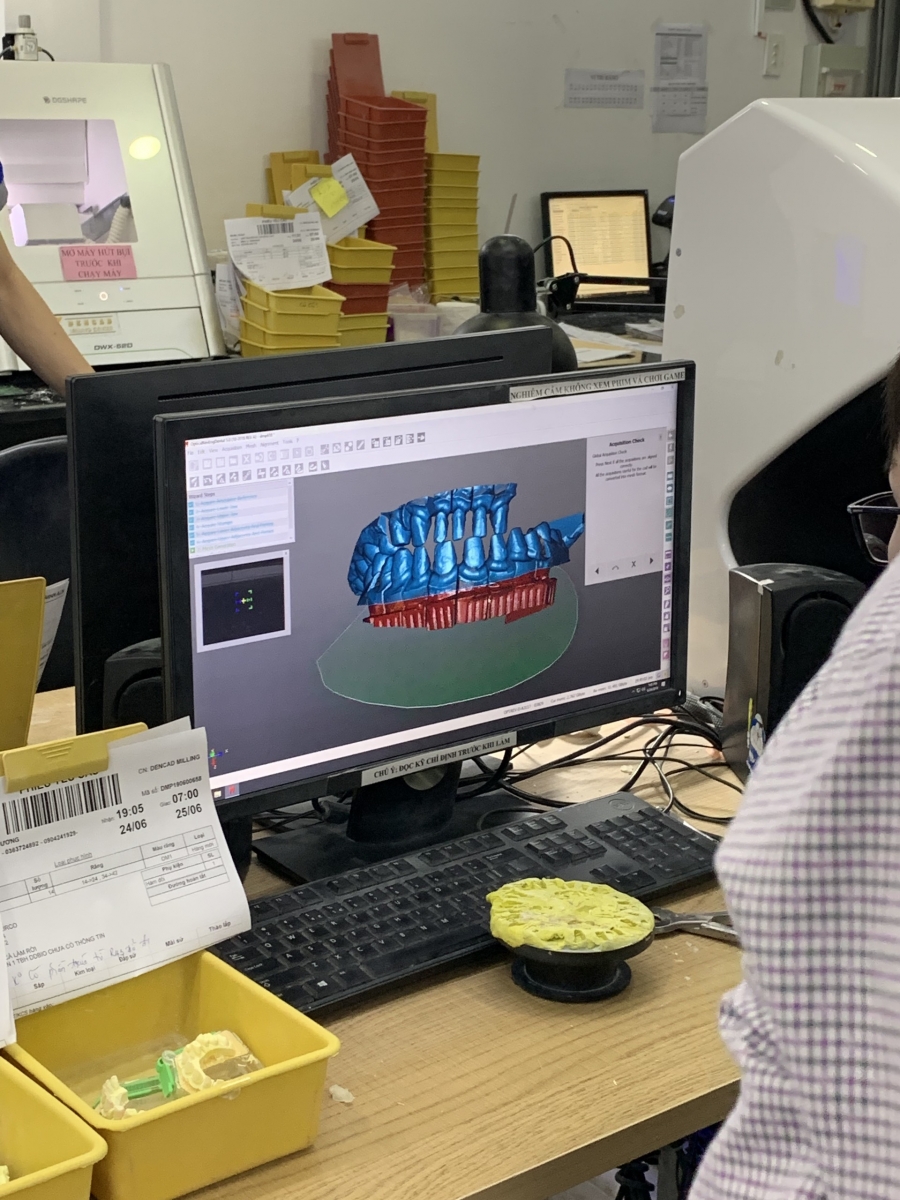 Chỉnh sửa mô hình răng