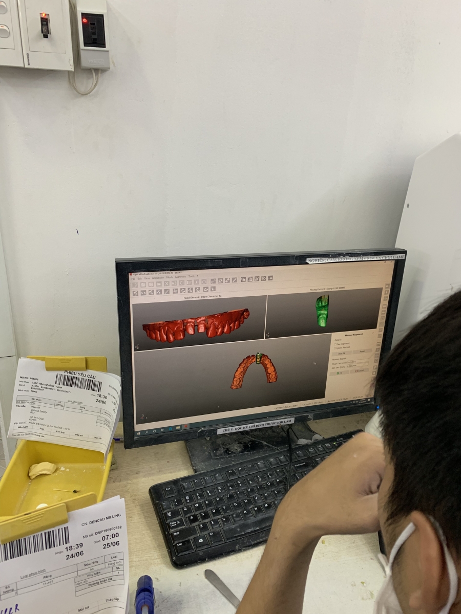 MÔ HÌNH HÓA RĂNG